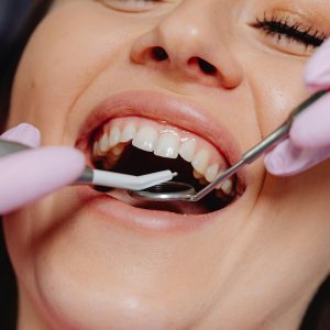 Smiling woman at dentist with tools for dental exam, highlighting dental care.
